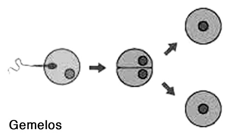 diagrama de embarazo de trillizos